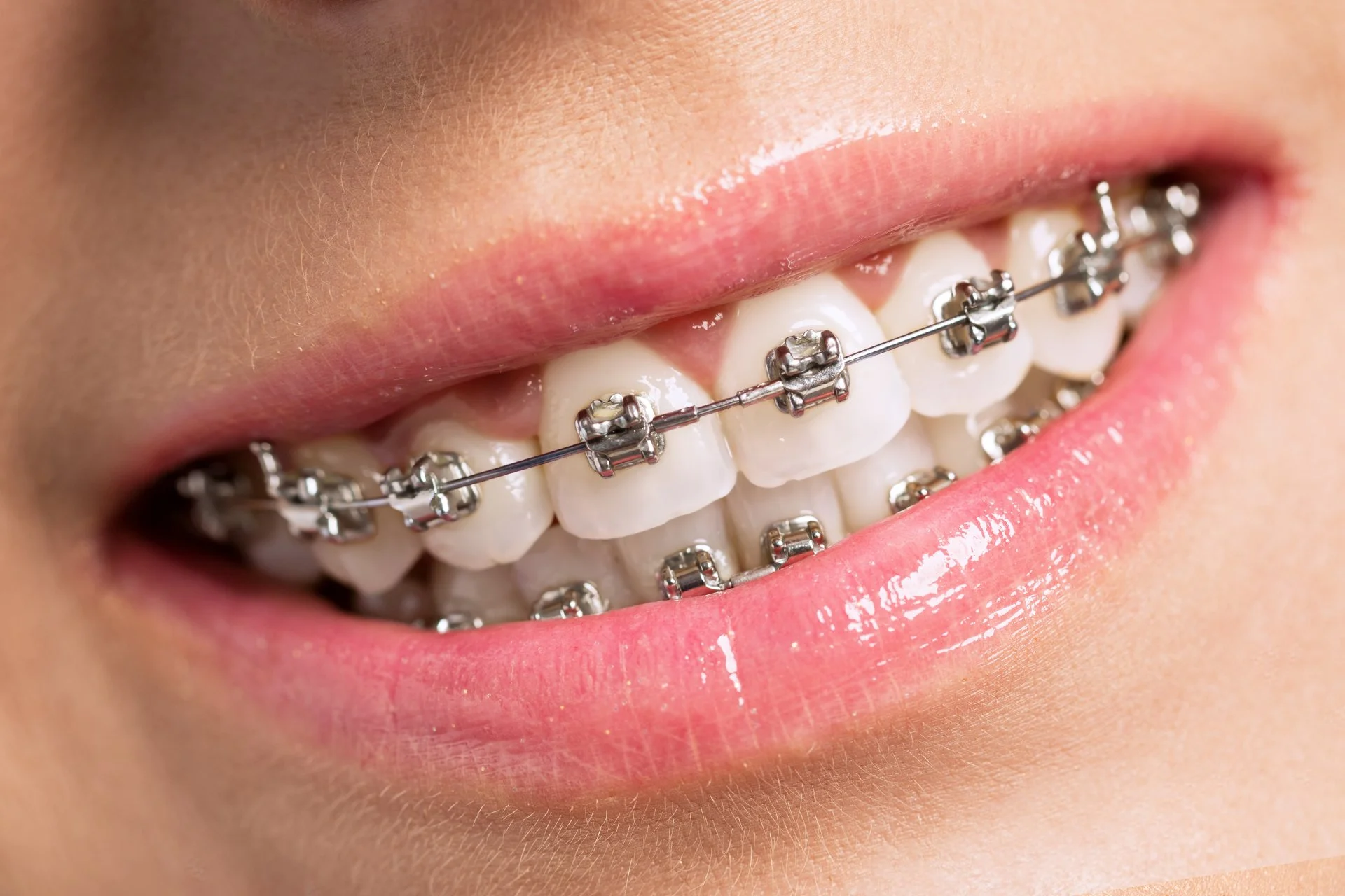 Orthodontics