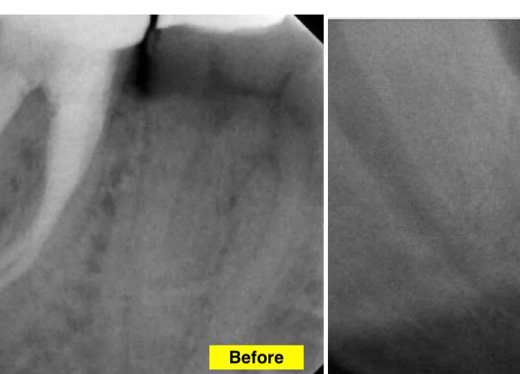case11