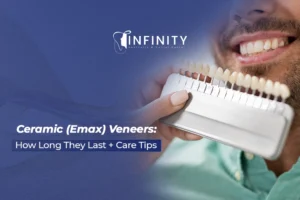 how long do ceramic veneers last