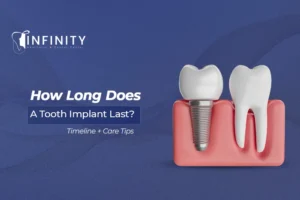 how long does a tooth implant last