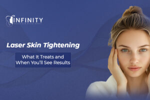 skin tightening services