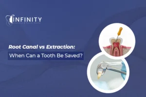 root canal dubai