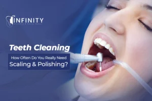 teeth cleaning near me