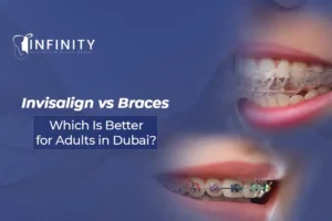 invisalign vs braces