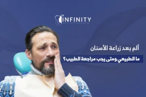 الم بعد زراعة الاسنان