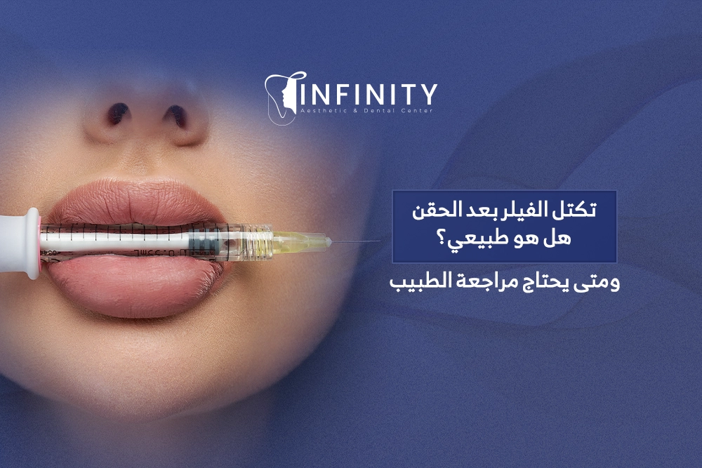 تكتل الفيلر بعد الحقن