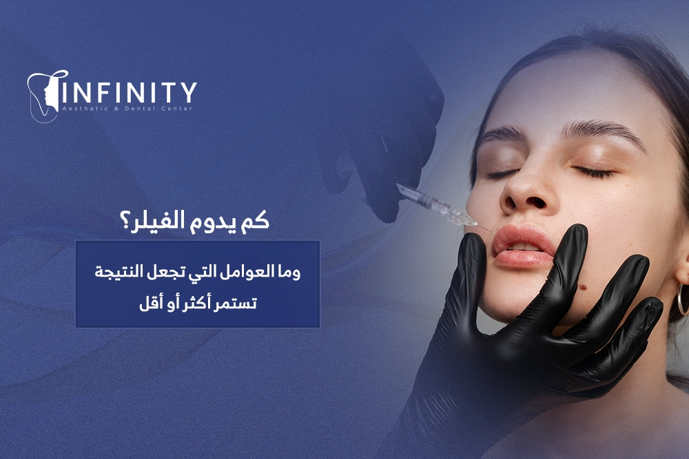 كم يدوم الفيلر