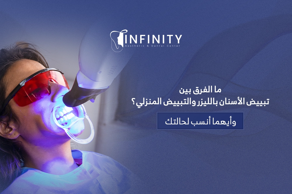 تبييض الاسنان بالليزر والتبييض المنزلي