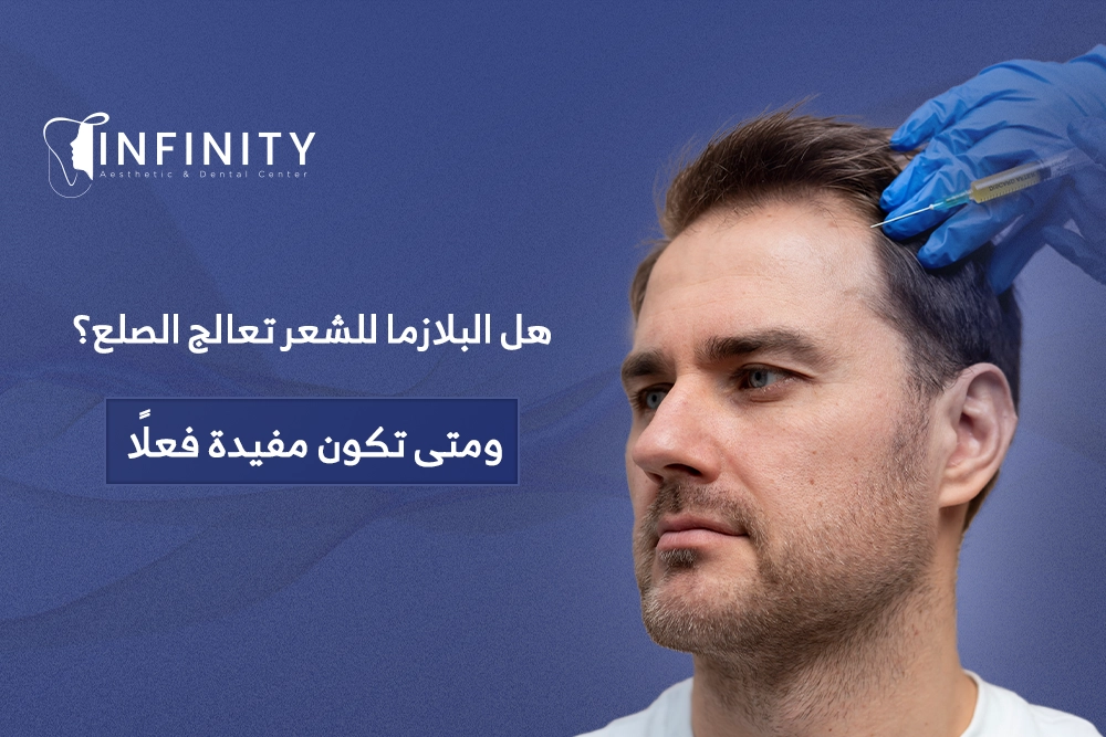 هل البلازما للشعر تعالج الصلع