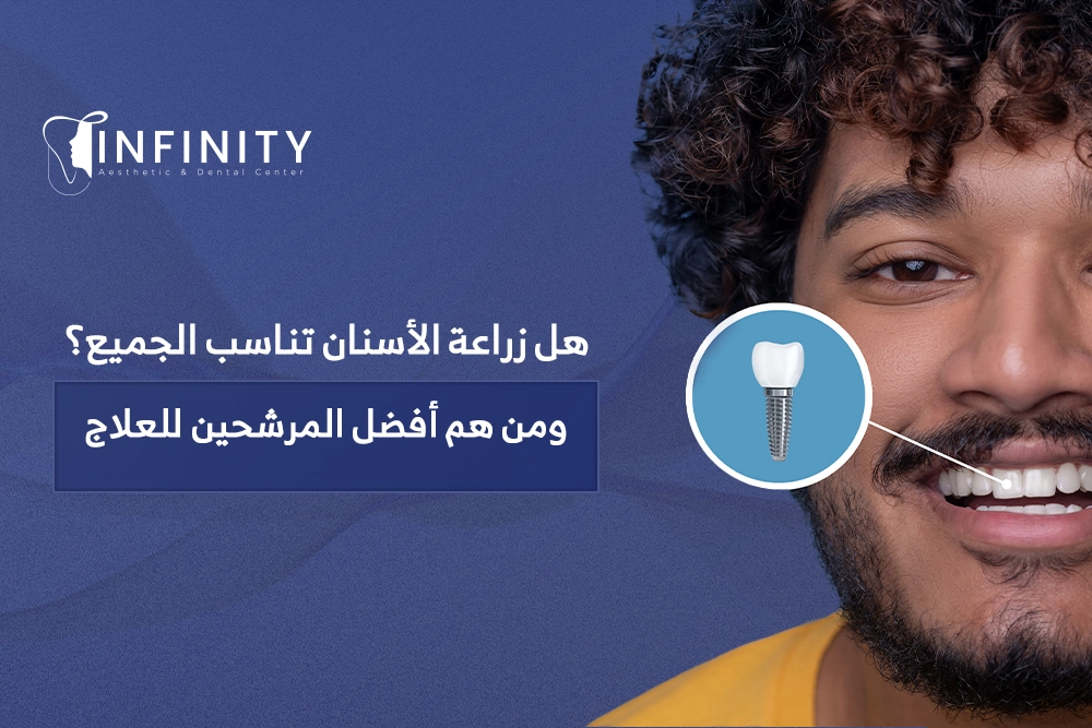 هل زراعة الاسنان تناسب الجميع