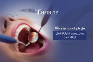 هل علاج العصب مؤلم