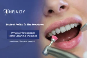 Scale and polish appointment in The Meadows