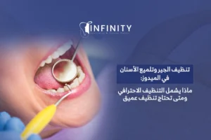 تنظيف الجير وتلميع الأسنان في الميدوز