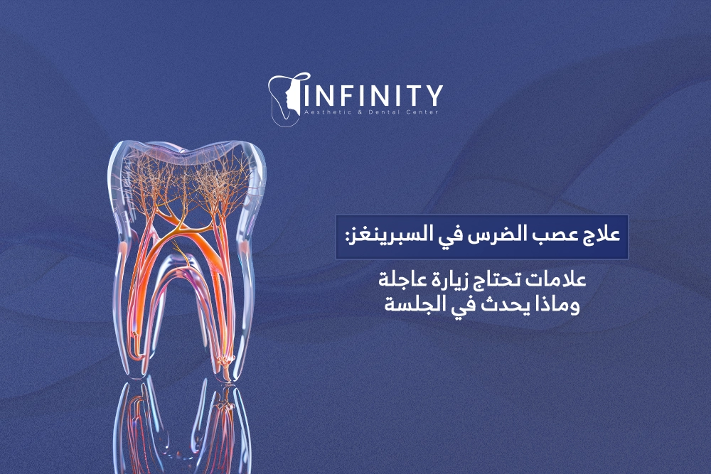 علاج عصب الضرس في السبرينغز