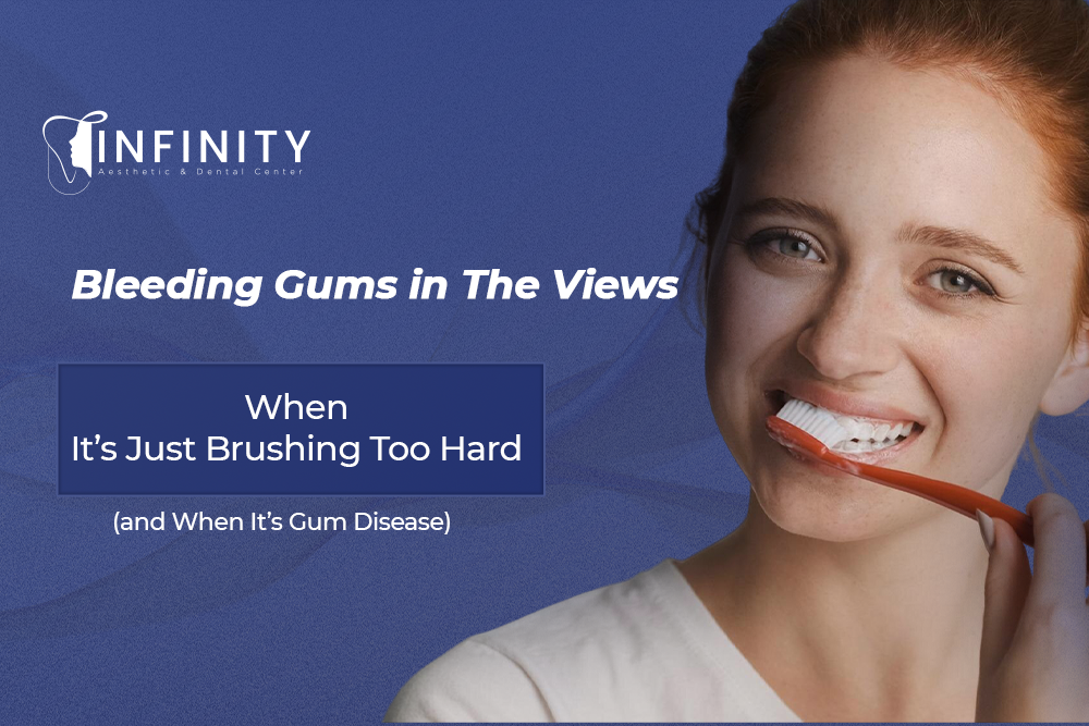 bleeding gums causes in The Views