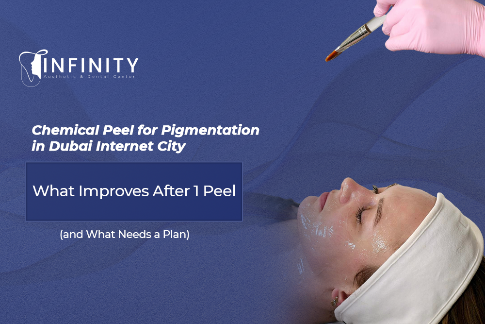chemical peel for pigmentation