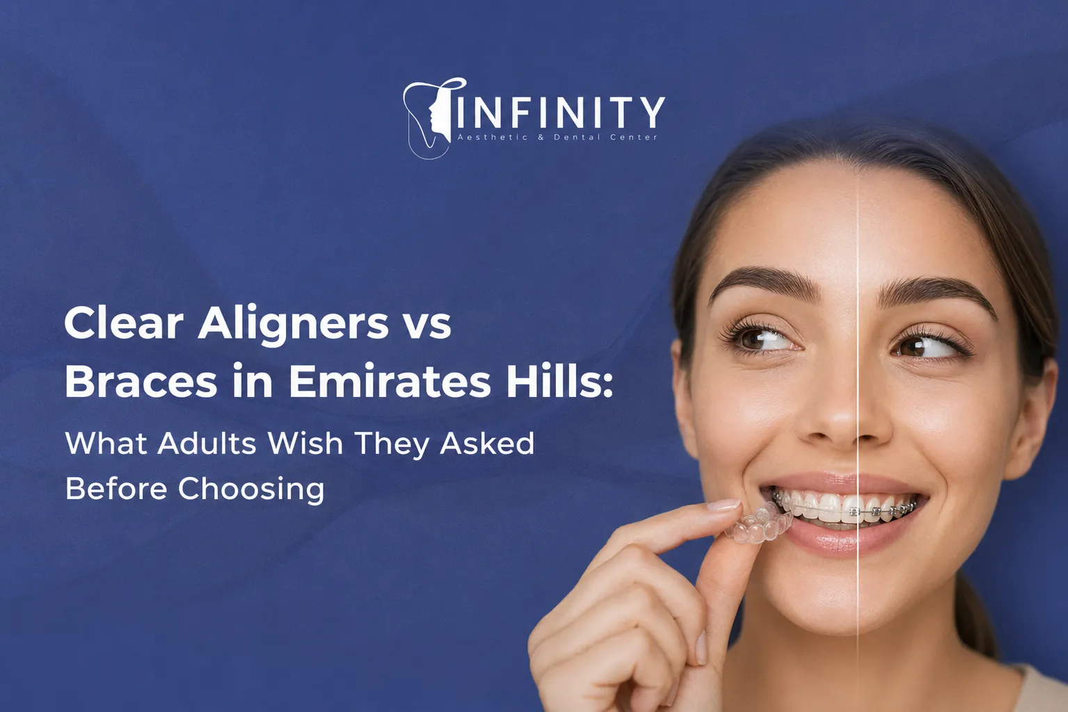 clear aligners vs braces in Emirates Hills