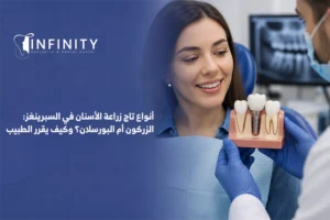خيارات تاج زراعة الاسنان في السبرينغز