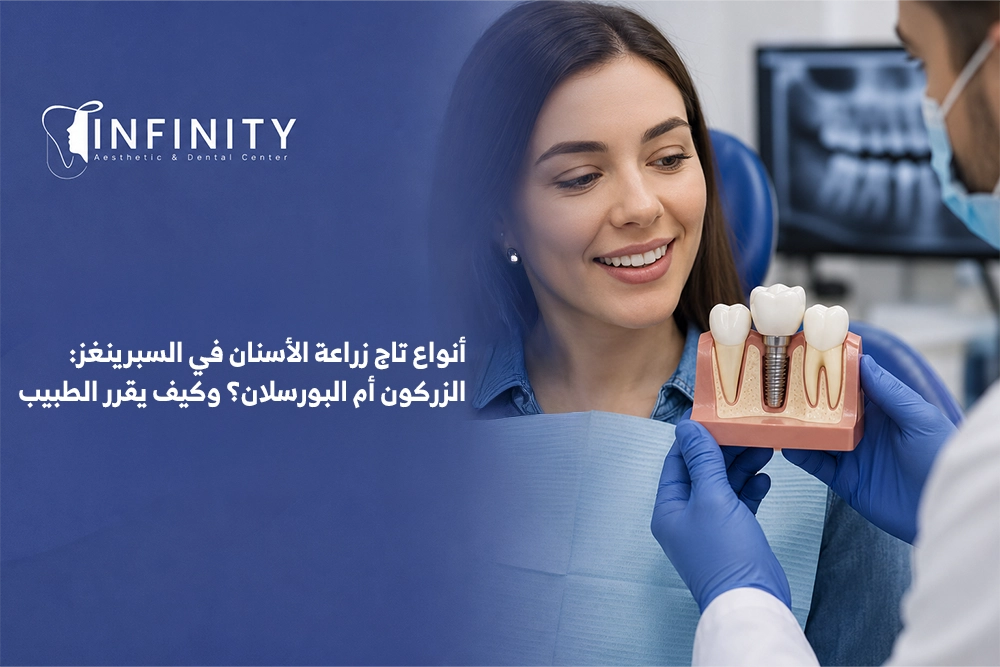 خيارات تاج زراعة الاسنان في السبرينغز