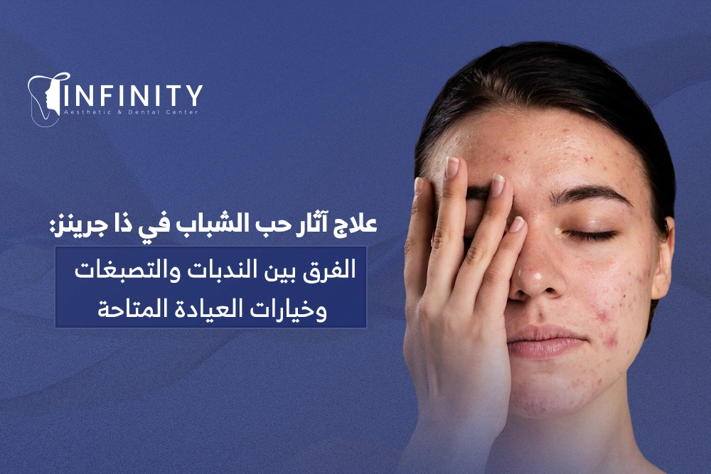 علاج اثار حب الشباب في ذا جرينز