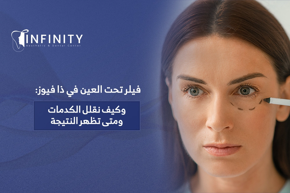 فيلر تحت العين في ذا فيوز