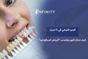 فينير طبيعي في ذا جرينز