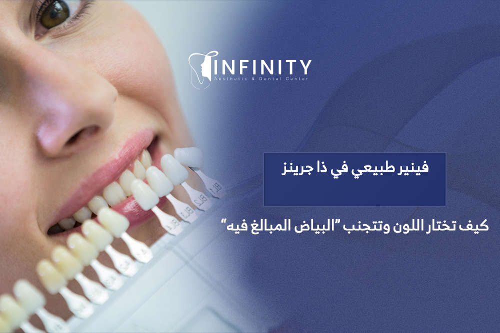 فينير طبيعي في ذا جرينز