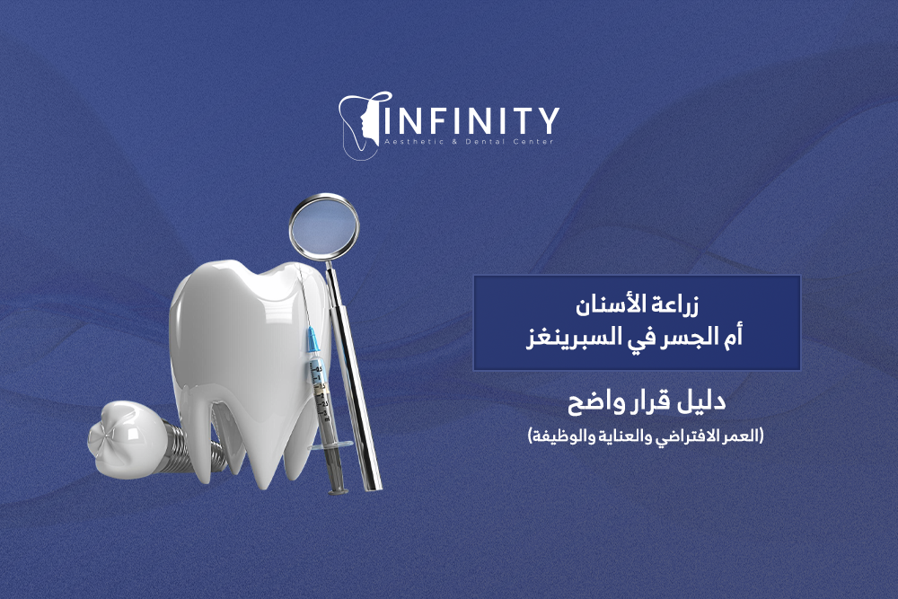 زراعة الأسنان أم الجسر في السبرينغز