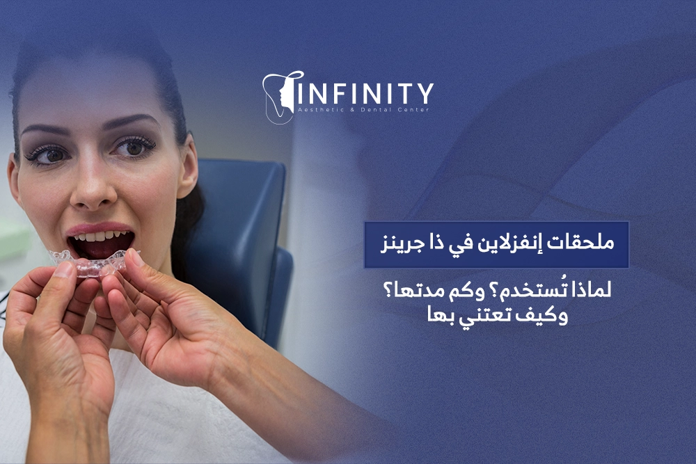 ملحقات إنفزلاين في ذا جرينز
