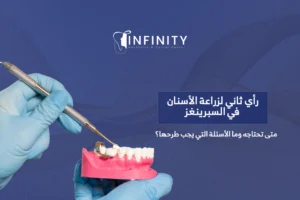 رأي ثاني لزراعة الأسنان في السبرينغز