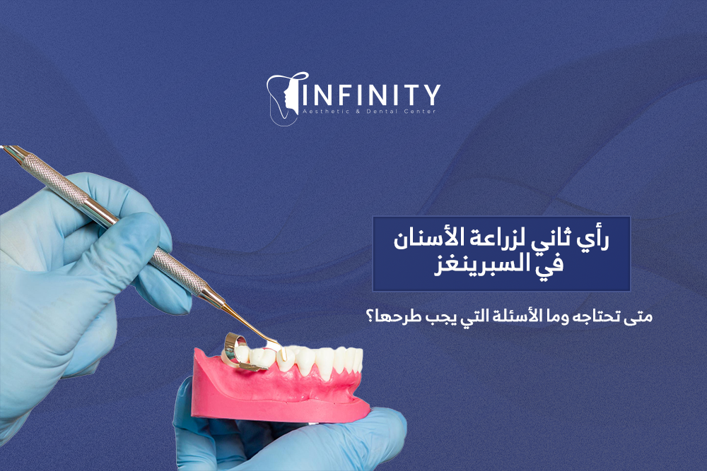رأي ثاني لزراعة الأسنان في السبرينغز