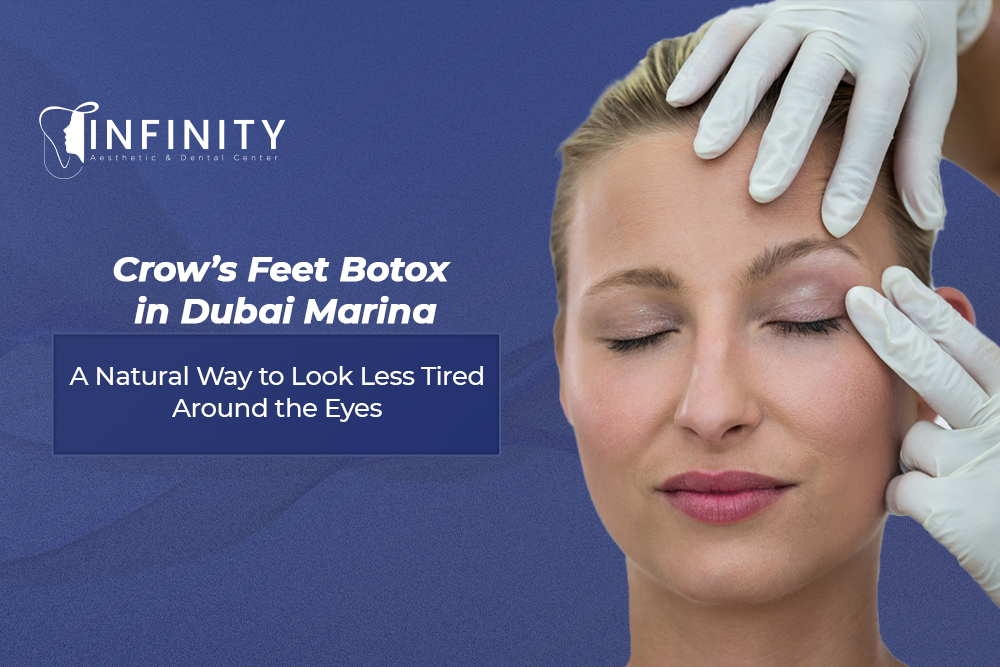 crow's feet Botox in Dubai Marina