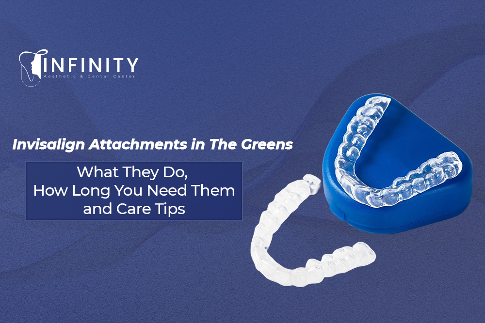Invisalign Attachments in The Greens