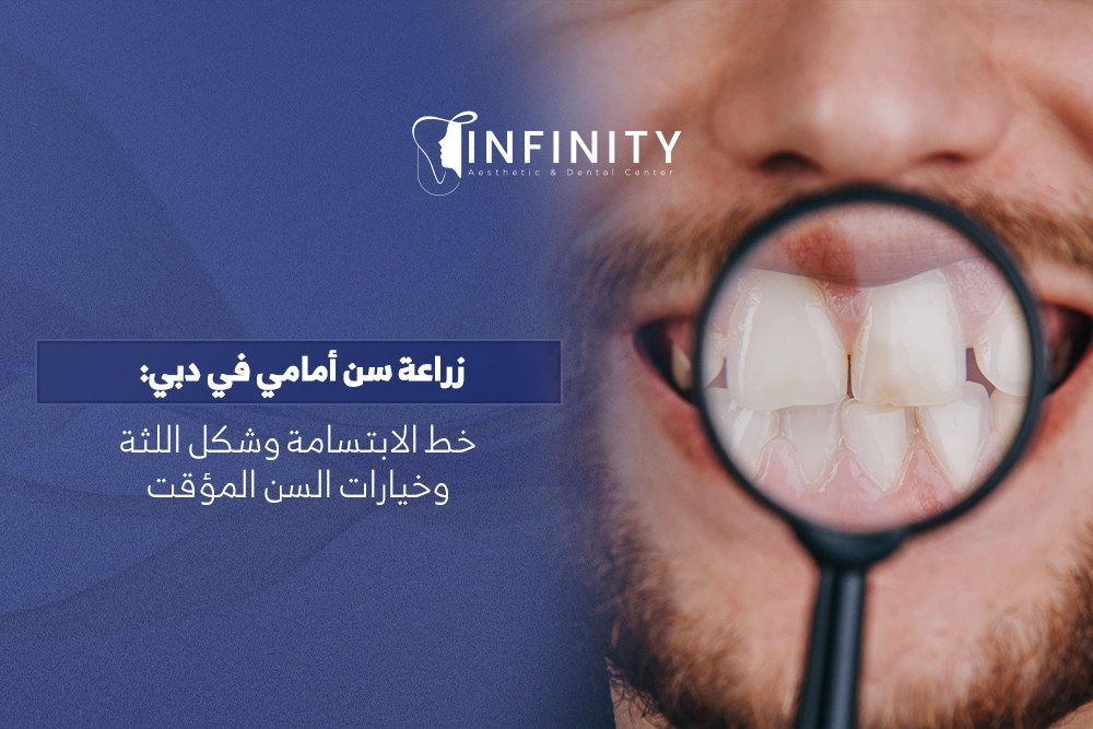 زراعة سن أمامي في دبي