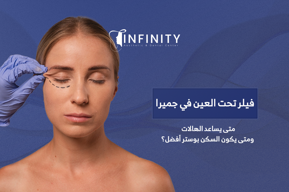 فيلر تحت العين في جميرا