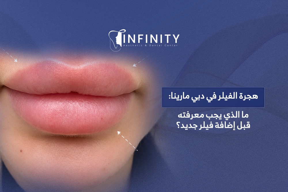 هجرة الفيلر في دبي مارينا