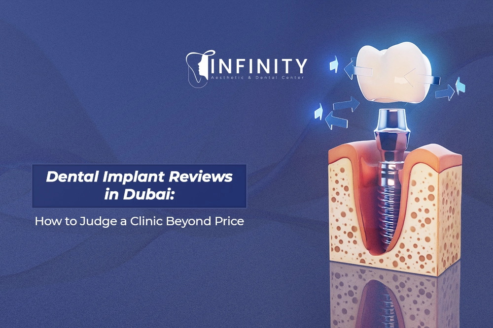 dental implant reviews dubai