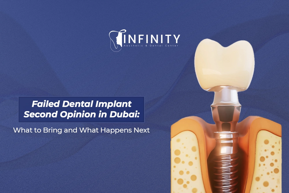 dental implant second opinion