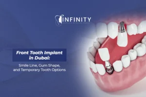 front tooth implant Dubai