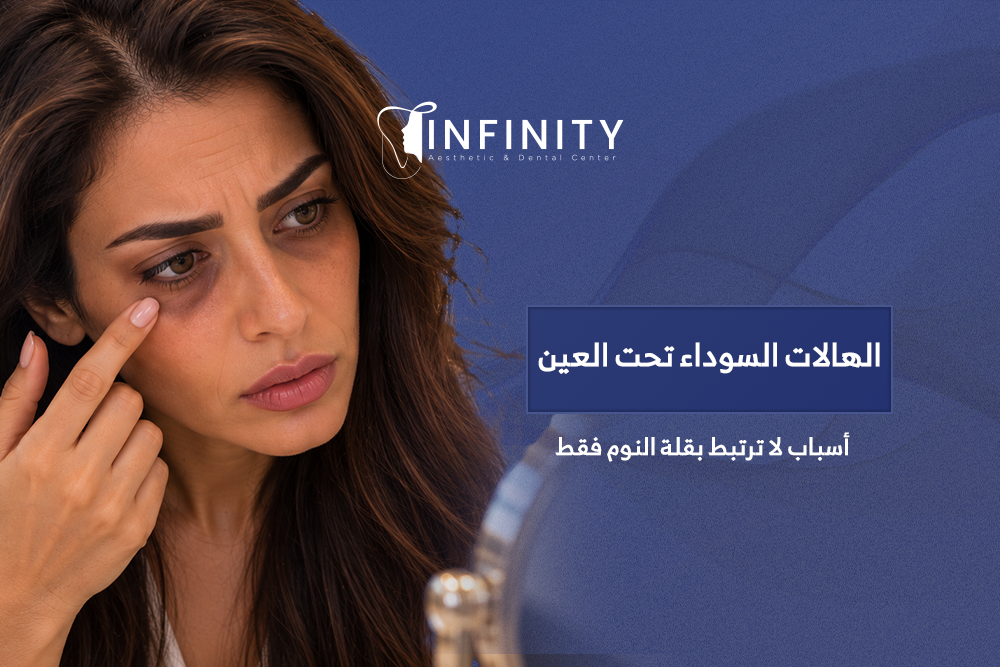 الهالات السوداء تحت العين